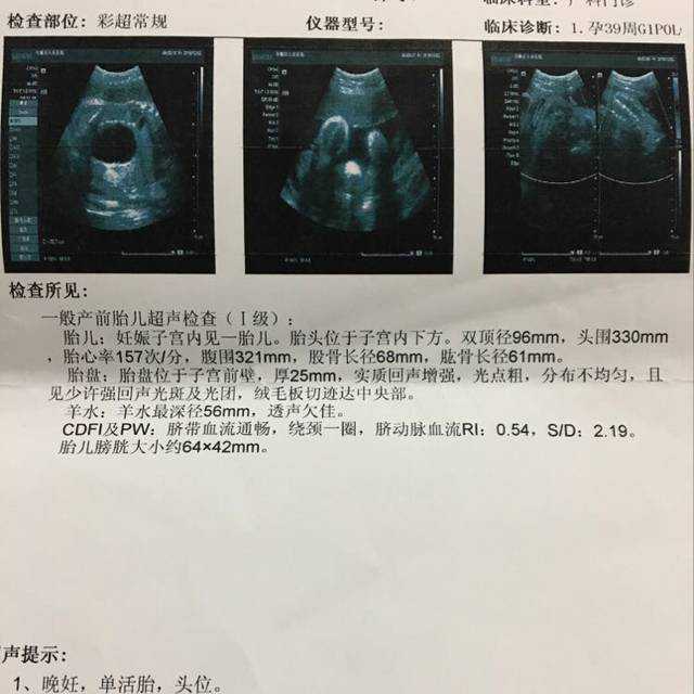 上海借卵自怀费用，上海借卵助孕机构排名前10名单一览！附借卵生男孩费用明